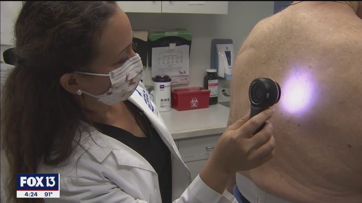Dermatologists use the alphabet to check for melanoma